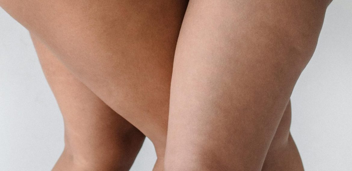 Cellulite: Strategie macrobiotiche per sciogliere grasso e cellulite in estate